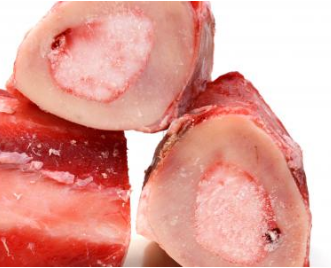 معالجة نخاع العظام