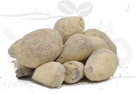 تفتيت حصوات الكلى والمثانة